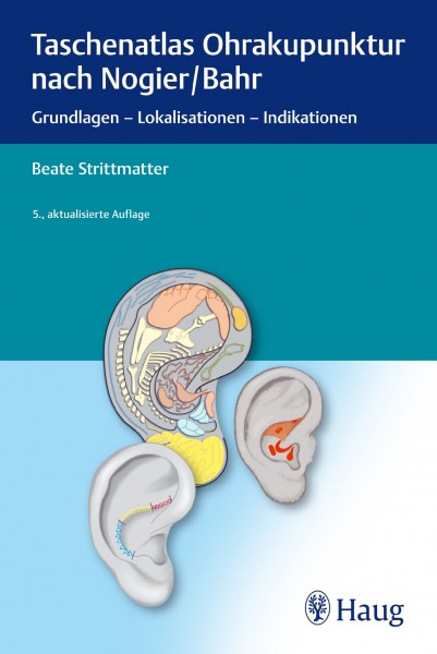 Ohrakupunktur